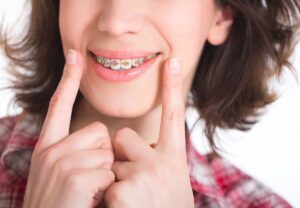 How to Care for Your Braces During Coronavirus
