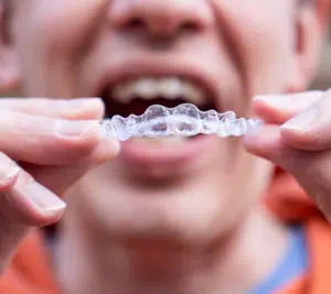 Invisalign Treatment