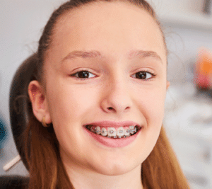 Braces for teens