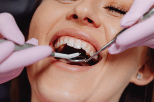 A Guide to Phase 1 Orthodontic Treatment