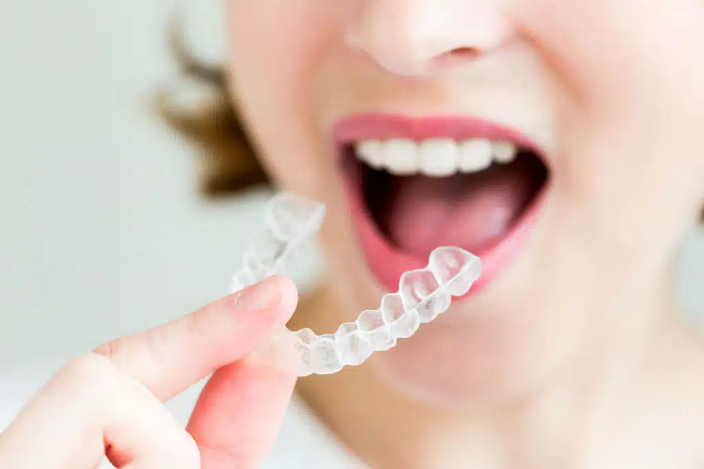 What Can Invisalign Fix for Crooked and Crowded Teeth