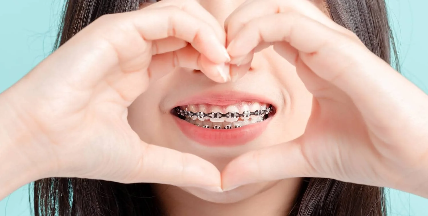 First Week with Braces Tips for a Smooth Start